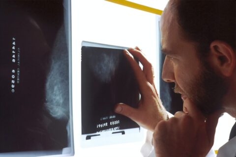 Diagnoza: rak